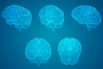 求20个最难的脑筋急转弯